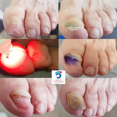 Gabinet podologiczny Podo-Nova Anna Mosor - Podolog Bielsko